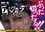 アミグダラ